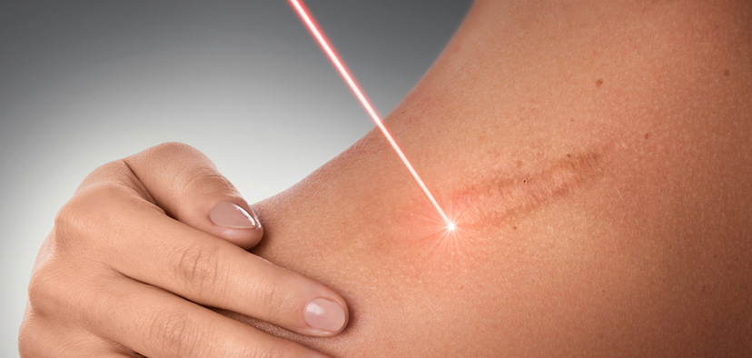 Why laser therapy