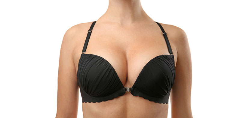 Breast-Lift-after