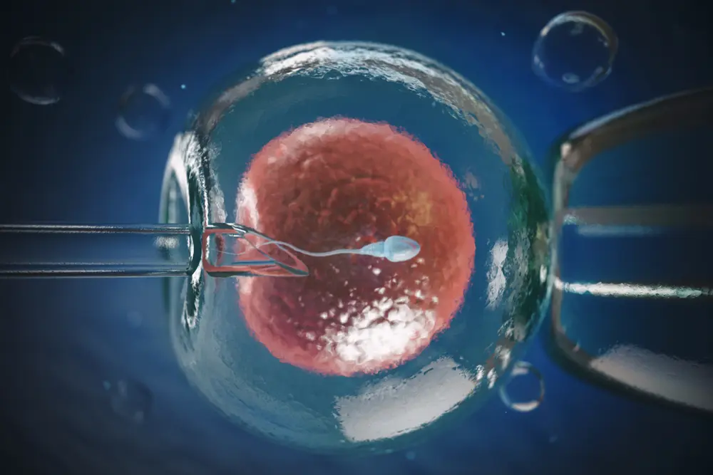 Who is an ideal candidate for IVF?